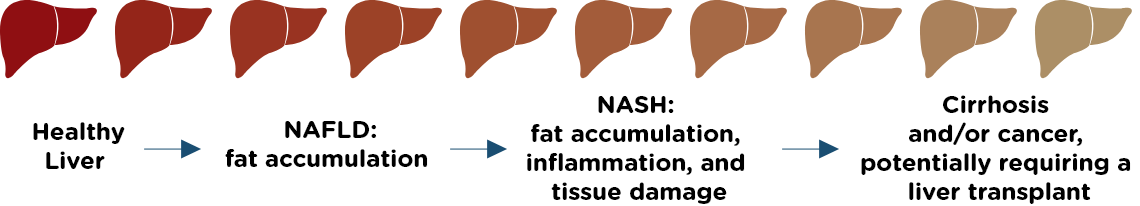 NASH Fibronostics