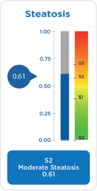 steatosis score chart