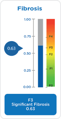 fibrosis score chart
