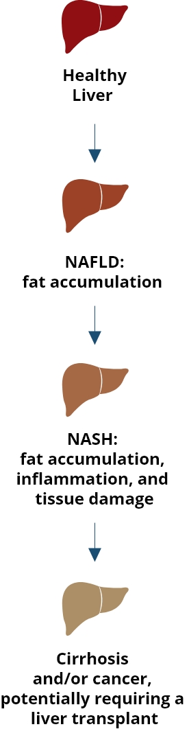 NASH Fibronostics