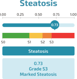 steatosis score chart