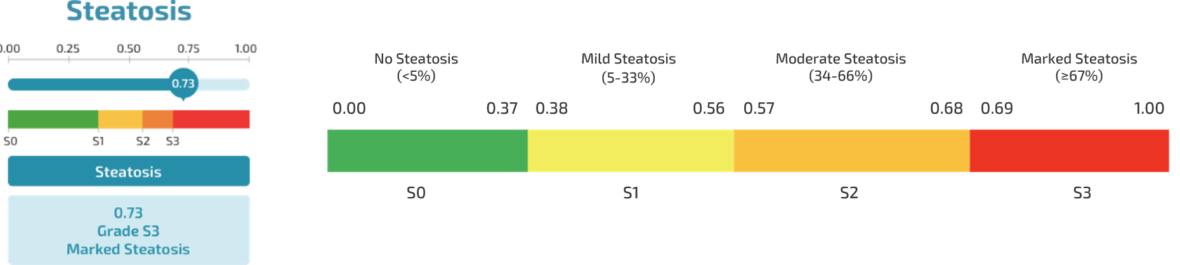 steatosis score chart